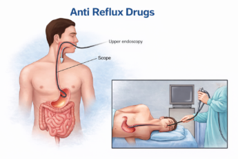 anti Reflux Drugs