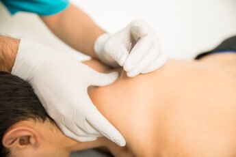 what is acupuncture points