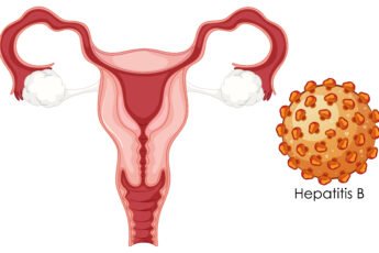 Vulvodynia