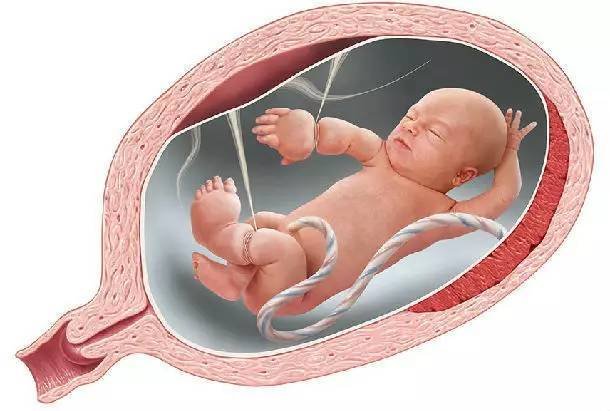 What Is Amniotic Band Syndrome?