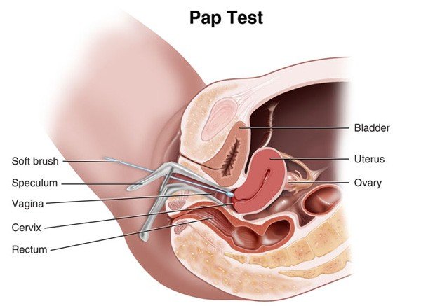 What is a Pap test? Healthinfi