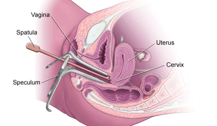 What is a Pap test? Healthinfi