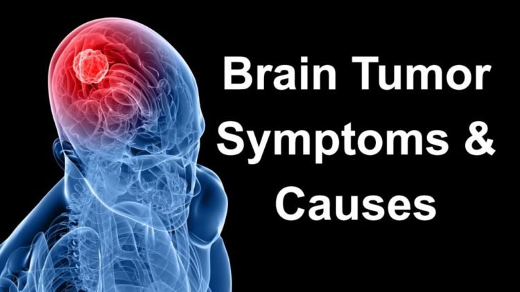 What Is a Brain Tumor?