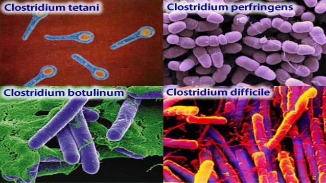 Botulism: Causes, Symptoms & Diagnosis Healthinfi