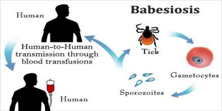 What Is Babesia? Symptoms, Treatment And Prevention.