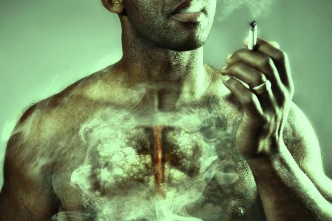 Emphysema - Types, Symptoms, Causes, Diagnosis, Stages - Healthinfi