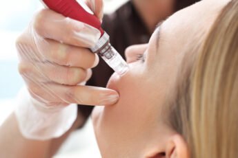 Where Should You Get Microneedling for Skin Rejuvenation in San Diego?