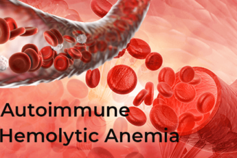 Autoimmune hemolytic anemia treatment, Types of autoimmune hemolytic anemia, Autoimmune hemolytic anemia symptoms