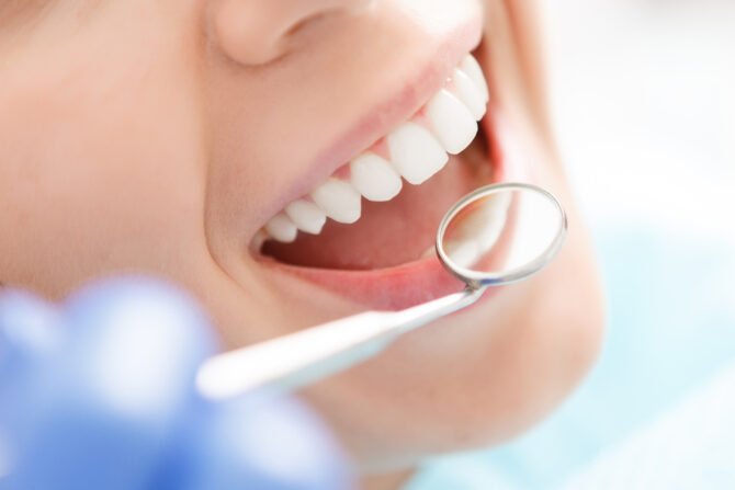 What Are the Most Typical Dental Problems in Surry Hills?