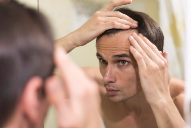 low testosterone and hair loss