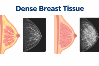 dense breast tissue