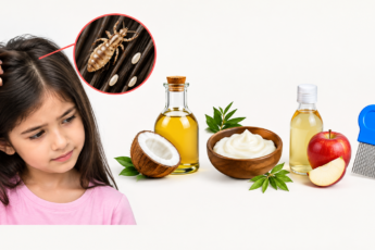 lice and nits home remedies