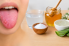 tongue bumps remedies
