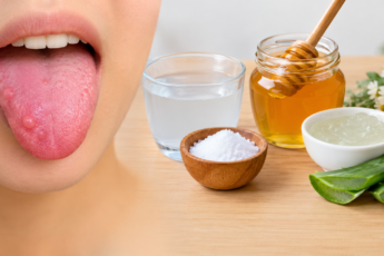 tongue bumps remedies