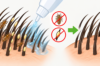 what kills lice eggs